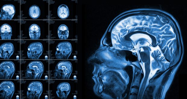 Different views of MRI of the human brain